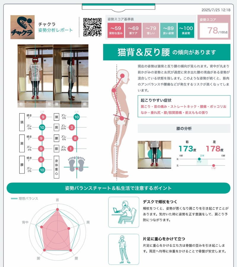 椎間板ヘルニア