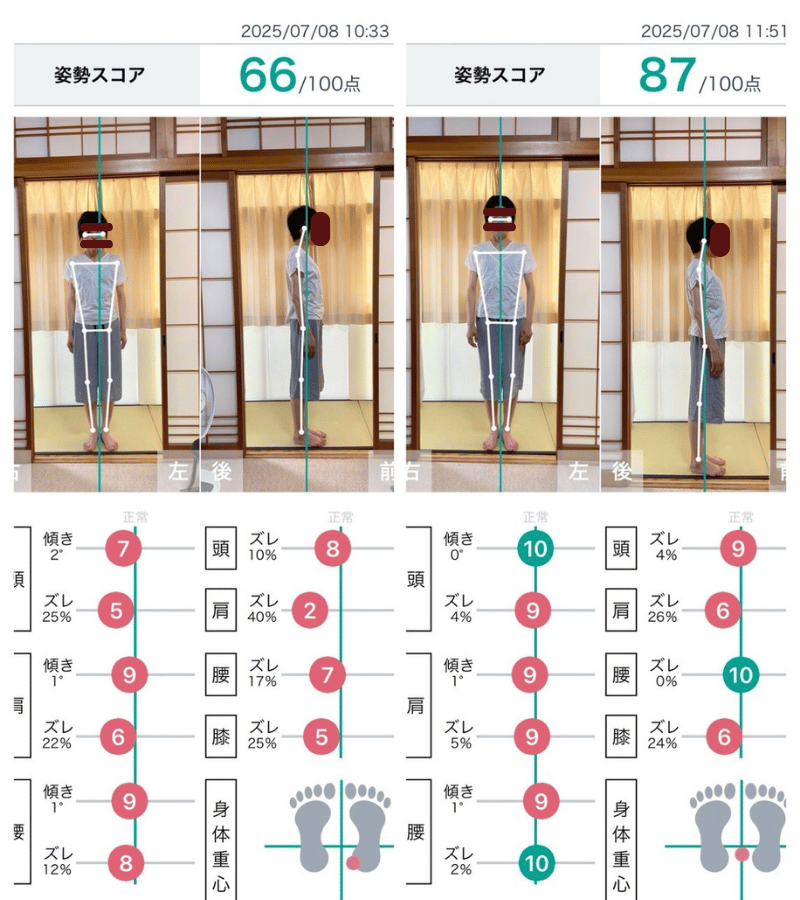 慢性的な肩こりや腰の張り、バランスの崩れによる疲労感が出や